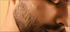 Can a Dermaroller 0.25mm Stimulate Beard Growth?