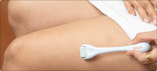 derma-roller-for-stretch-marks