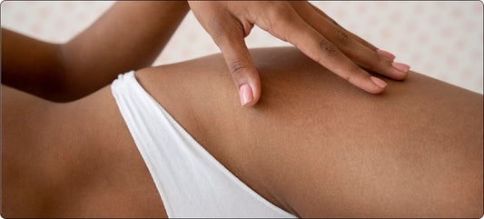 microneedling-for-scars